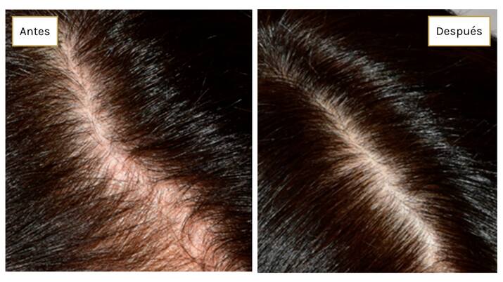 DSD de Luxe estudio clínico