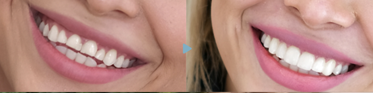Belleza integral: la sonrisa como parte del bienestar personal